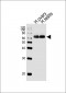 ESR2 Antibody (Center)